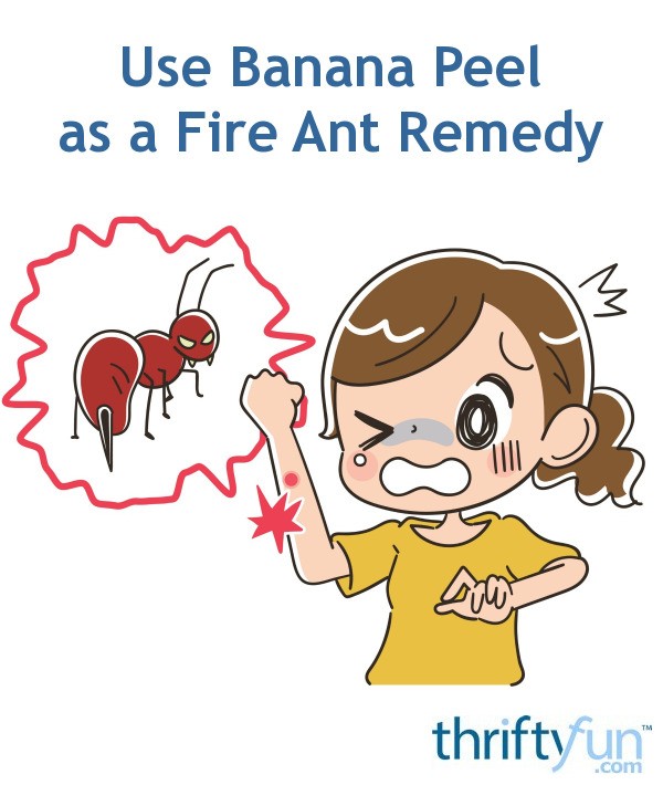 heal fire ant bites