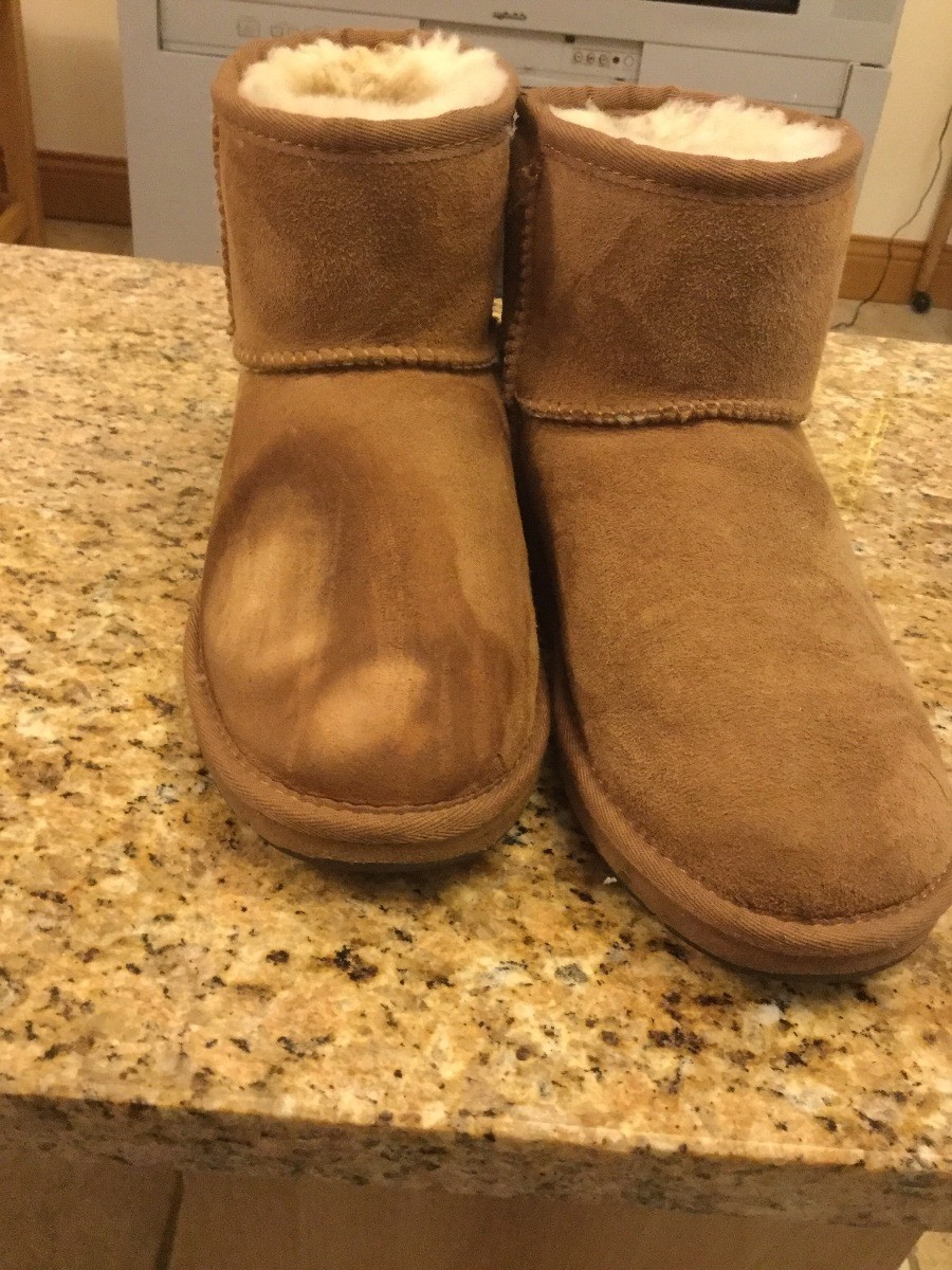 ugg slippers fur coming off