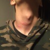 Insect bites on the neck of a person.