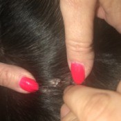 Lump on Dog's Belly - bumpy growth