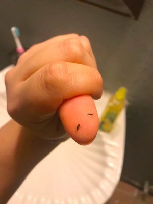 Identifying Small Brown Biting Bugs - two little bugs on the end of her thumb