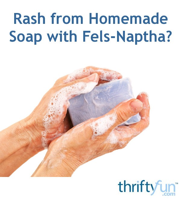 Can Homemade Soap Containing Fels Naptha Cause A Rash ThriftyFun