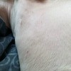 Identifying a Bump on My Pit Bull - large bump behind dog's front leg
