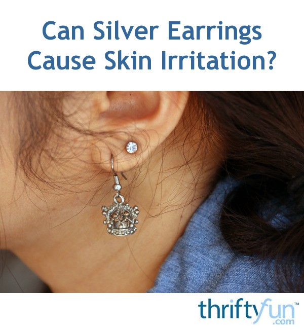 Can Silver Earrings Cause Skin Irritation? ThriftyFun