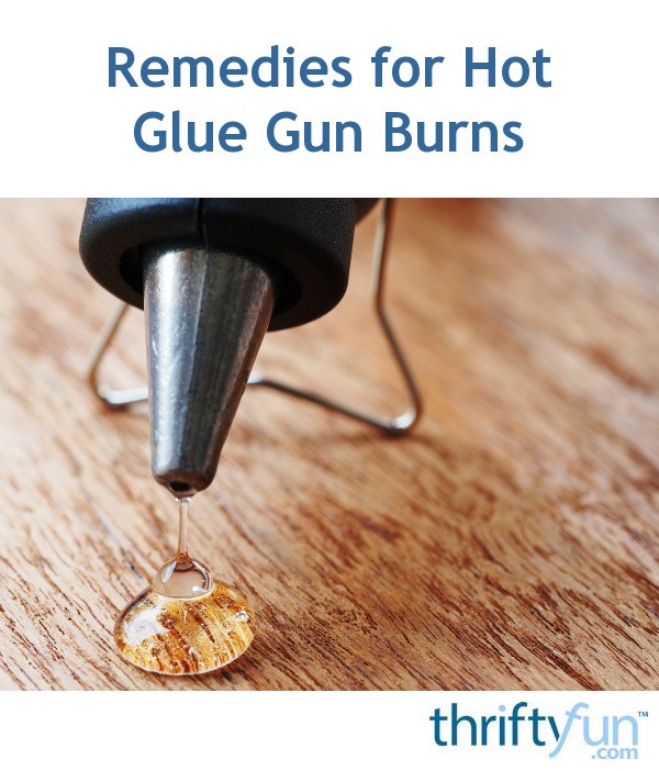 Remedies For Hot Glue Gun Burns Thriftyfun
