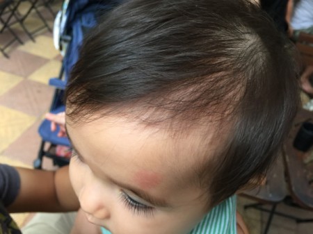 Top of baby's scalp