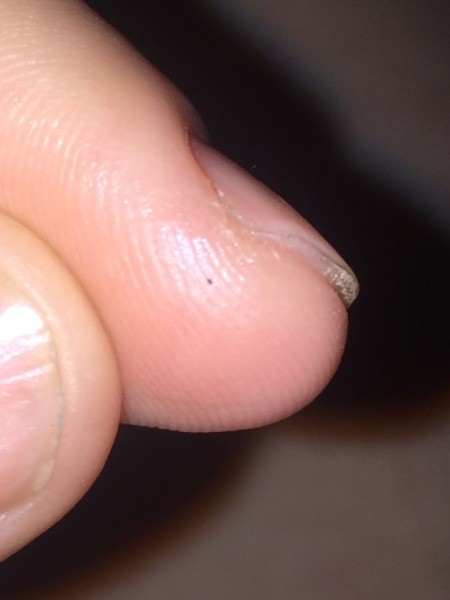 Getting Rid of Small Black Biting Bugs