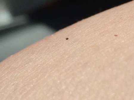 Getting Rid of Small Black Biting Bugs