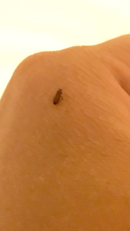 Getting Rid of Small Brown/Black Bugs in an Apartment