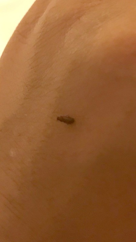 Getting Rid of Small Brown/Black Bugs in an Apartment