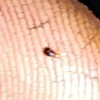 Identifying Tiny Biting Bugs - tiny dark brown bug