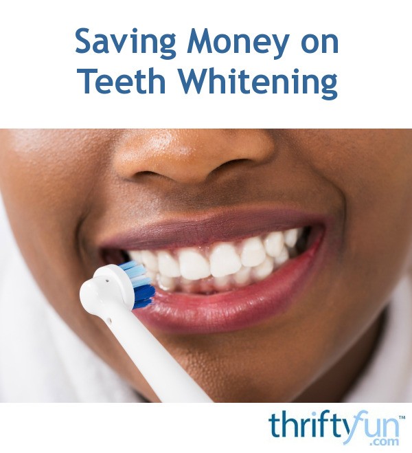Saving Money on Teeth Whitening | ThriftyFun