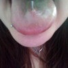 Is My Tongue Piercing Infected?