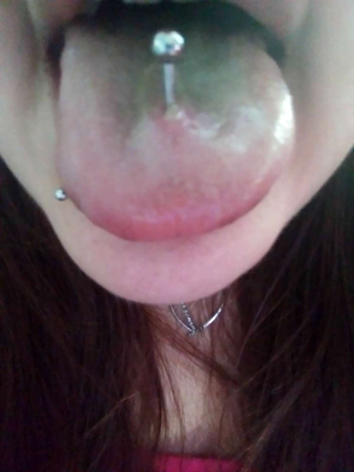 Tongue bubble under my Painful Sores,