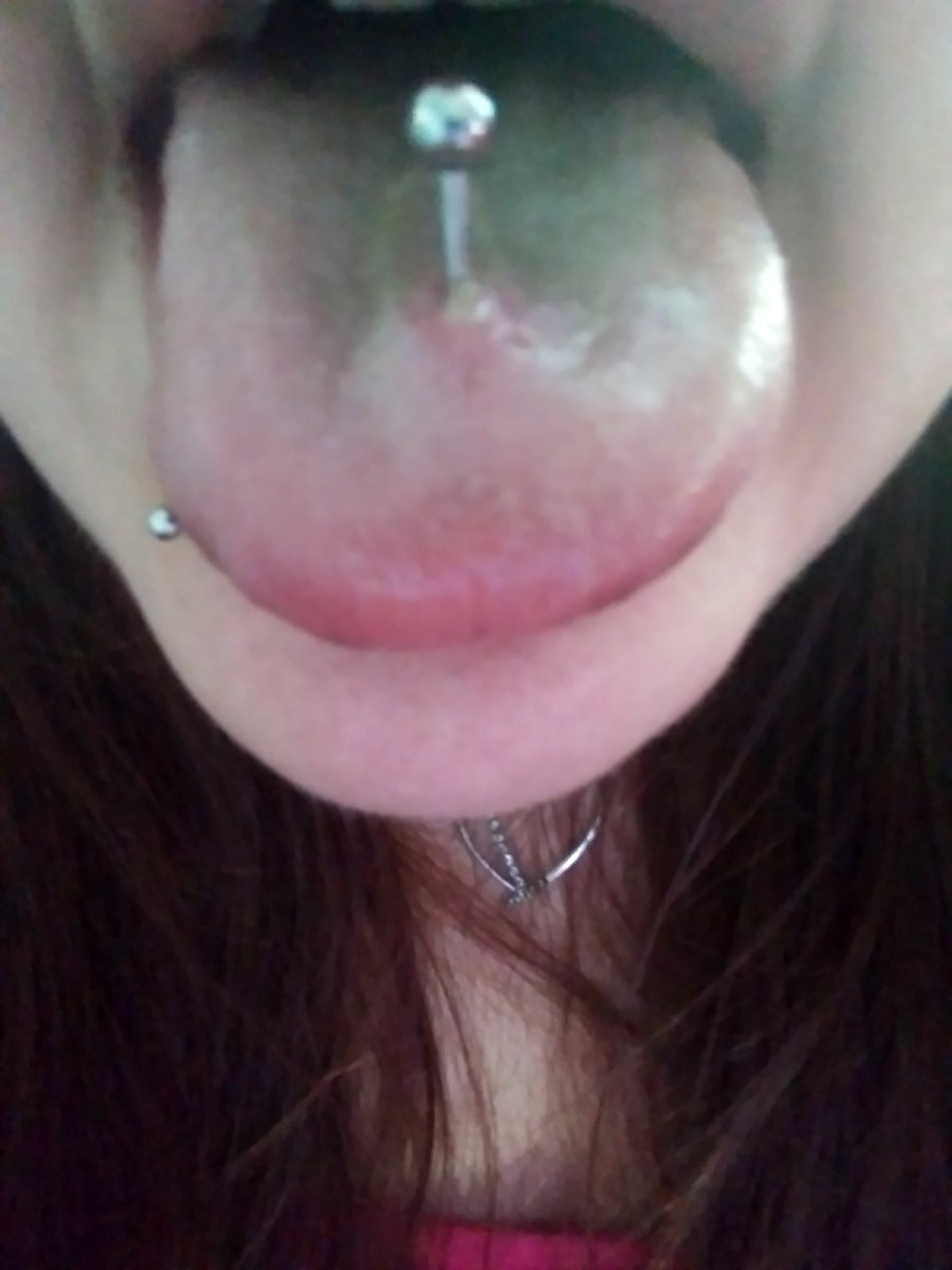 Problems With A Tongue Piercing Thriftyfun