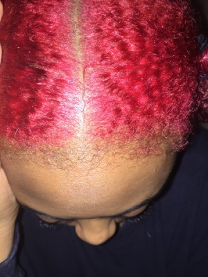 Dyeing Roots After Bleaching Hair - view of part in very red hair
