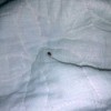 Identifying a Small Bug Found in Bed