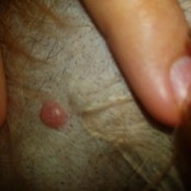 Identifying a Bump on a Dog's Belly