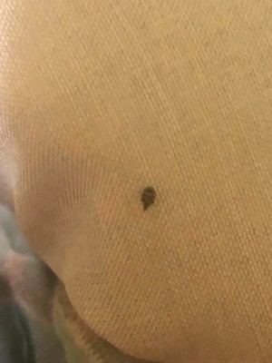 Identifying Household Bugs - bug on fabric