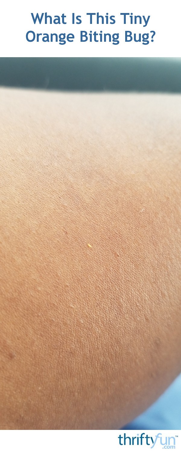 Tiny Orange Bugs That Bite Asking List