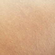 What Is This Tiny Orange Biting Bug?