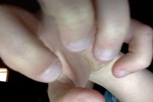 Trying to Stop Biting Nails - fingers with bitten nails