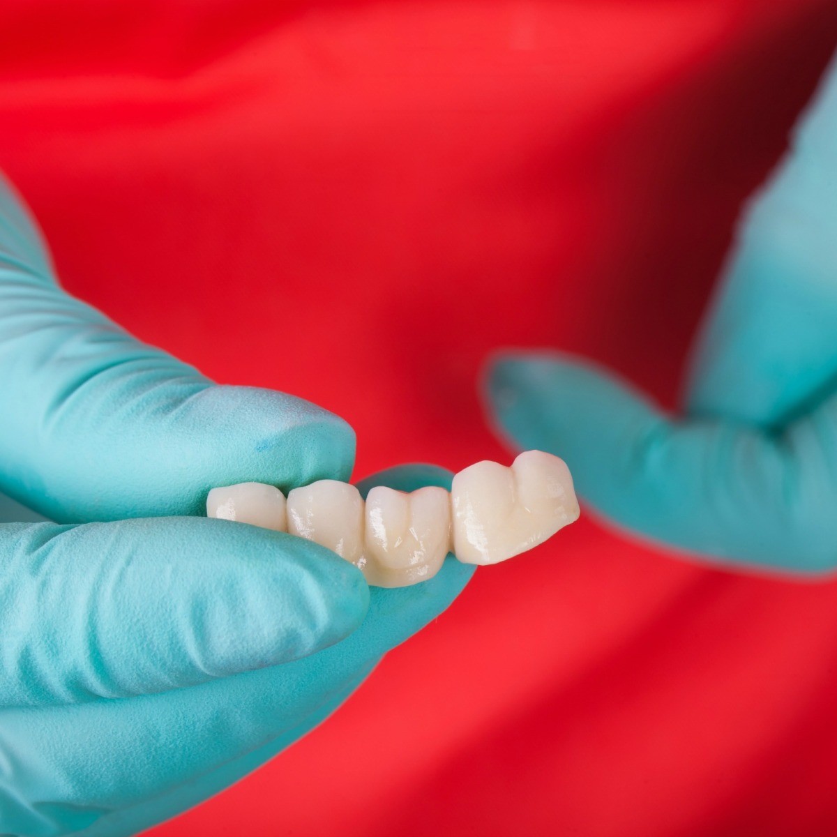 Repairing a Dental Bridge? ThriftyFun