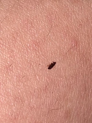 Identifying Small Brown Bugs - bug on skin