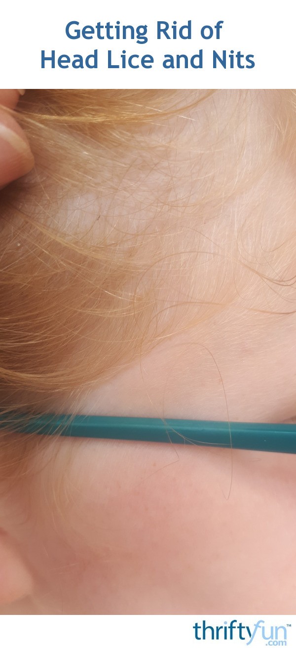 Getting Rid of Head Lice and Nits? ThriftyFun