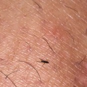 Identifying Little Black Biting Bugs - bug on skin