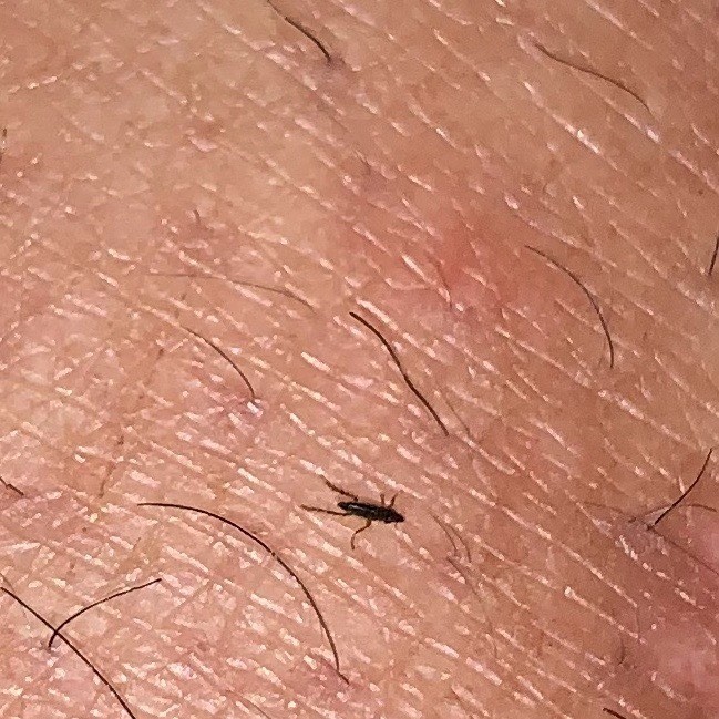 Identifying Little Black Biting Bugs 1 Tx4 