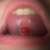 Tongue Piercing Hurts When Eating - piercing