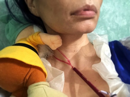 Snow White and the Undead Dwarves - outline of neck wound made with lip liner