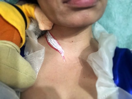 Snow White and the Undead Dwarves - paint on liquid latex in the wound