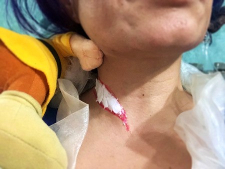 Snow White and the Undead Dwarves - dab on bits of TP in the wound