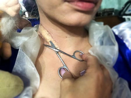 Snow White and the Undead Dwarves - use scissors to cut a slit end to end