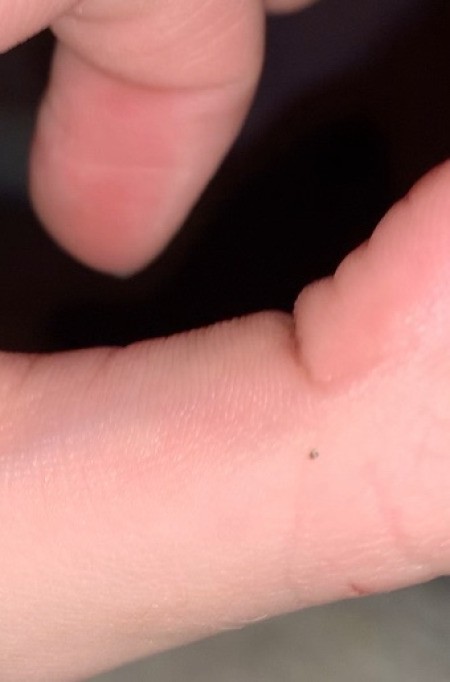 Identifying a Tiny Bug