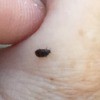 Identifying a Small Black Bug - closeup of a small black bug
