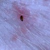 Identifying Bugs on Dog's Skin - bug attached to dog's skin