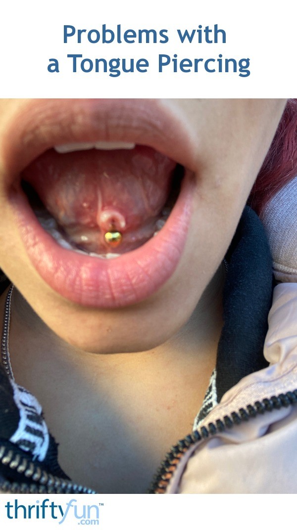 Problems with a Tongue Piercing? | ThriftyFun