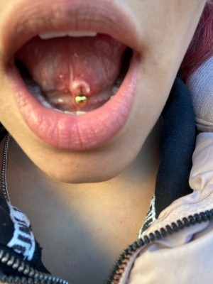Problems with a Tongue Piercing - underside of a tongue