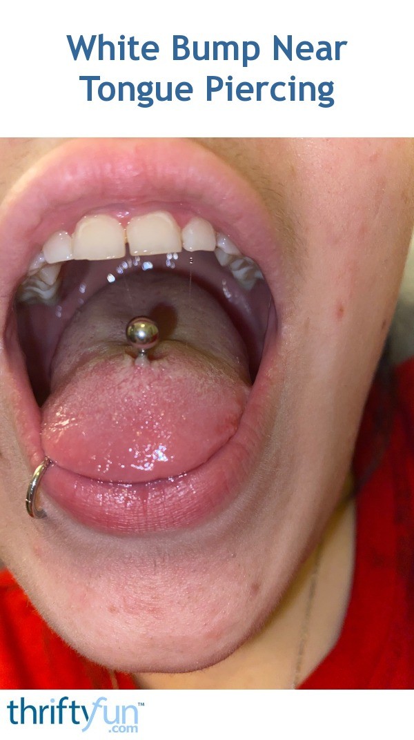 White Bump Near Tongue Piercing? | ThriftyFun