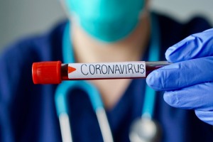 How to Protect Yourself Against the Coronavirus (COVID-19)