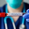 How to Protect Yourself Against the Coronavirus (COVID-19)