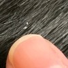 Identifying Tiny Black and White Biting Bugs - white bits in black hair