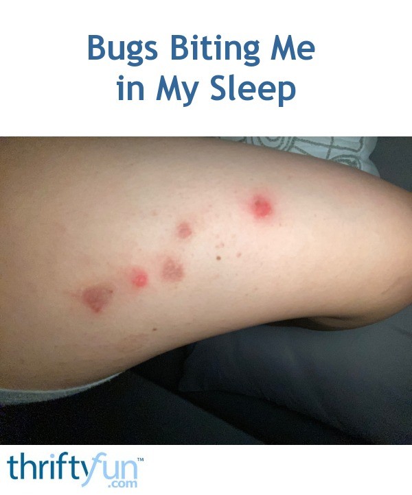 bugs-biting-me-in-my-sleep-thriftyfun