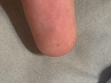 Identifying a Tiny Bug the Keeps Crawling on My Skin? - tiny black bug on finger tip