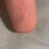 Identifying a Tiny Bug the Keeps Crawling on My Skin? - tiny black bug on finger tip