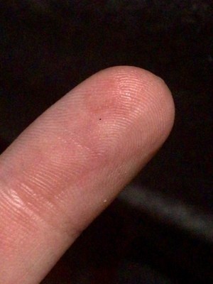 Identifying Super Tiny Black Biting Bugs?