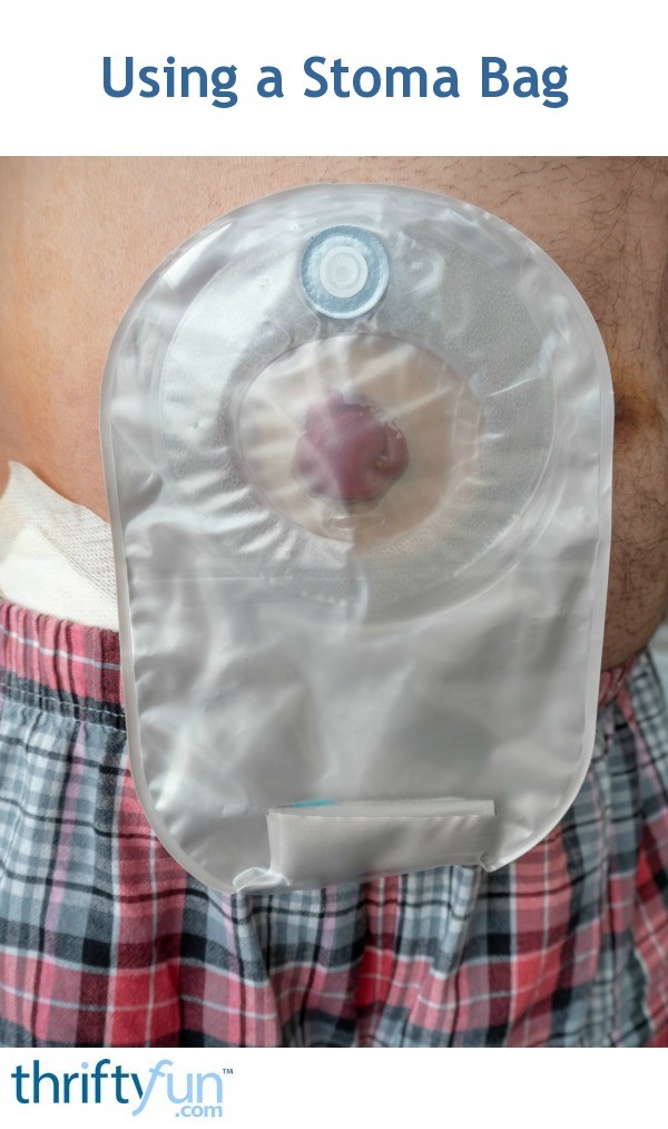 stoma bag using